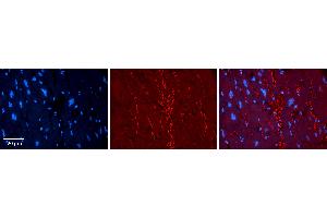 Rabbit Anti-KAT5 Antibody Catalog Number: ARP33345_P050 Formalin Fixed Paraffin Embedded Tissue: Human heart Tissue Observed Staining: Plasma membrane Primary Antibody Concentration: 1:100 Other Working Concentrations: 1:600 Secondary Antibody: Donkey anti-Rabbit-Cy3 Secondary Antibody Concentration: 1:200 Magnification: 20X Exposure Time: 0. (KAT5 抗体  (Middle Region))