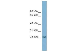 PERP antibody used at 1 ug/ml to detect target protein. (PERP 抗体  (Middle Region))