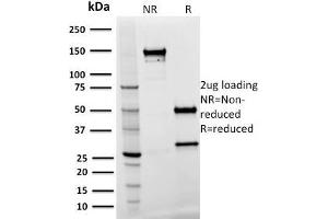 SDS-PAGE Analysis Purified SPASTIN Mouse Monoclonal Antibody (Sp 3G11-1). (Spastin 抗体)