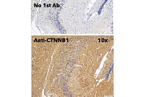 Immunohistochemistry (IHC) image for anti-Catenin, beta (CATNB) (C-Term) antibody (ABIN6254224)