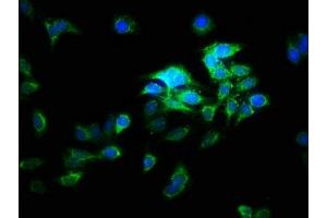 Immunofluorescence staining of HepG2 cells with ABIN7175254 at 1:166, counter-stained with DAPI. (ATP6V1E2 抗体  (AA 1-226))