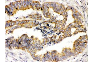 Immunohistochemistry (Paraffin-embedded Sections) (IHC (p)) image for anti-Transient Receptor Potential Cation Channel, Subfamily M, Member 4 (TRPM4) (AA 1079-1214) antibody (ABIN3044557)