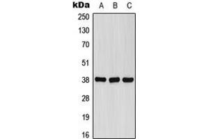 Western blot analysis of FPR1 expression in A549 (A), Raw264. (FPR1 抗体  (Center))
