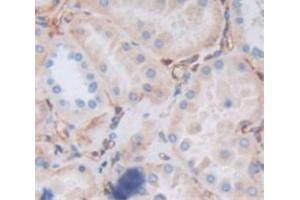 Used in DAB staining on fromalin fixed paraffin- embedded Kidney tissue (RYK 抗体  (AA 308-570))
