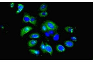 Immunofluorescent analysis of HepG2 cells using ABIN7156675 at dilution of 1:100 and Alexa Fluor 488-congugated AffiniPure Goat Anti-Rabbit IgG(H+L) (IFIT5 抗体  (AA 107-320))