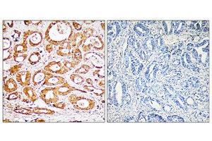 Immunohistochemistry (IHC) image for anti-Ribosomal Protein S19 (RPS19) (Internal Region) antibody (ABIN1850576) (RPS19 抗体  (Internal Region))