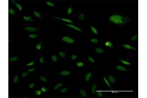 Immunofluorescence of monoclonal antibody to EXOSC5 on HeLa cell.