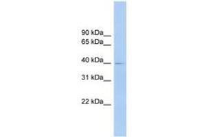 Image no. 1 for anti-Fc Receptor-Like A (FCRLA) (AA 287-336) antibody (ABIN6744875) (FCRLA 抗体  (AA 287-336))