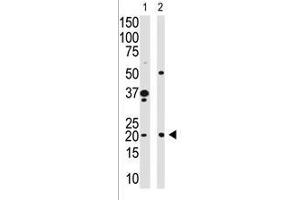 Image no. 1 for anti-Hippocalcin (HPCA) (N-Term) antibody (ABIN357112) (Hippocalcin 抗体  (N-Term))