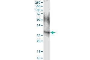 Immunoprecipitation of ARHGDIA transfected lysate using anti-ARHGDIA MaxPab rabbit polyclonal antibody and Protein A Magnetic Bead , and immunoblotted with ARHGDIA MaxPab mouse polyclonal antibody (B01) . (ARHGDIA 抗体  (AA 1-204))