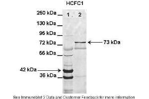 Lanes:   Lane1: HIS-HCFC1 16-363aa (42kD) transformed bacteria lysate Lane2: GFP-HCFC1 363-2002aa (73kD) transformed bacteria lysate elution sample  Primary Antibody Dilution:   1:1000  Secondary Antibody:   Anti-rabbit AlexaFluor 680  Secondary Antibody Dilution:   1:10000  Gene Name:   HCFC1  Submitted by:   Anonymous (HCFC1 抗体  (N-Term))