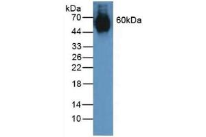 Detection of ELN in Human Lung Tissue using Polyclonal Antibody to Elastin (ELN) (Elastin 抗体  (AA 392-645))