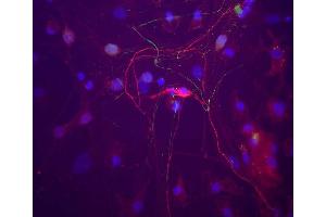 A neuron in a rat cortical neuron culture which stains strongly for peripherin with ABIN1580457 (red). (Peripherin 抗体)