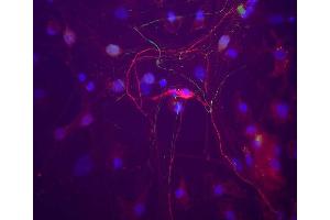 A neuron in a rat cortical neuron culture which stains strongly for peripherin with ABIN1580457 (red).