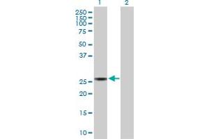 Western Blot analysis of SPR expression in transfected 293T cell line by SPR MaxPab polyclonal antibody. (SPR 抗体  (AA 1-261))