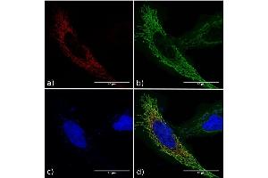 Immunofluorescence staining of fixed HeLa cells expressing mCherry tagged GCN4 with anti-GCN4 antibody C11L34. (Recombinant GCN4 抗体)