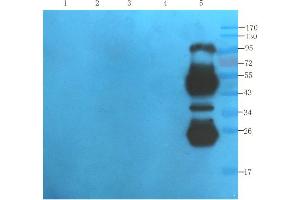 Western Blot using anti-IL2R antibody   Mouse lipocyte (lane 1), mouse spleen (lane 2), mouse thymus (lane 3), mouse lymph node (lane 4) and human thyroid tumour (lane 5) samples were resolved on a 10% SDS PAGE gel and blots probed with  at 1. (Recombinant IL2RA (Daclizumab Biosimilar) 抗体)