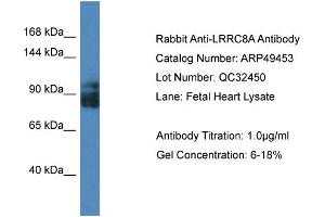 WB Suggested Anti-LRRC8A Antibody Titration:  0. (LRRC8A 抗体  (Middle Region))