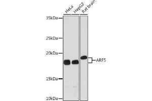 Western blot analysis of extracts of various cell lines, using  Rabbit mAb (ABIN7265484) at 1:1000 dilution. (ARF5 抗体)