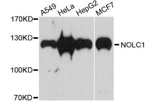 Western blot analysis of extracts of various cell lines, using NOLC1 antibody. (NOLC1 抗体  (AA 400-699))