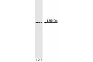 Western blot analysis of TAF[II] 135 on Jurkat lysate. (TAF4 抗体  (AA 454-565))