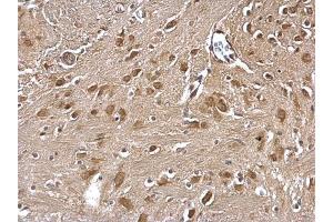 IHC-P Image GLMN antibody detects GLMN protein at cytosol on mouse fore brain by immunohistochemical analysis.