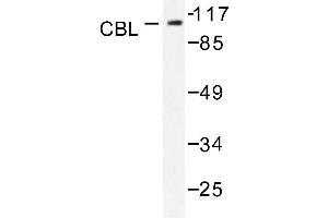 Image no. 1 for anti-Cas-Br-M (Murine) Ecotropic Retroviral Transforming Sequence (CBL) antibody (ABIN271925) (CBL 抗体)
