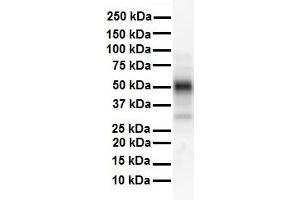 Western Blotting (WB) image for anti-Estrogen Receptor 2 (ESR2) (N-Term) antibody (ABIN2776499)