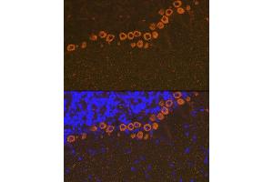 Immunofluorescence analysis of mouse brain using IP3R Rabbit mAb (ABIN1679064, ABIN3018927, ABIN3018928 and ABIN7101690) at dilution of 1:100 (40x lens). (ITPR1 抗体)