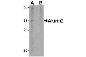 Image no. 1 for anti-Akirin 2 (AKIRIN2) (Internal Region) antibody (ABIN342720) (AKIRIN2 抗体  (Internal Region))