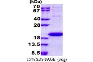 SDS-PAGE (SDS) image for Interleukin 1 Family Member 9 (IL1F9) (AA 1-169) protein (His tag) (ABIN5853123) (IL1F9 Protein (AA 1-169) (His tag))