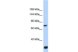 Host:  Rabbit  Target Name:  FNDC3A  Sample Type:  Fetal Brain lysates  Antibody Dilution:  1. (FNDC3A 抗体  (N-Term))