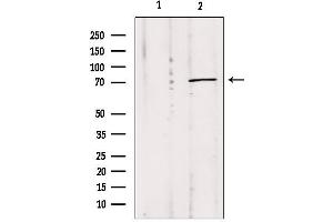 Western blot analysis of extracts from Mouse Myeloma cell, using MPP5 antibody. (MPP5 抗体  (C-Term))