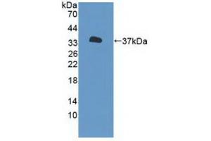 Western blot analysis of recombinant Human P2RX7. (P2RX7 抗体  (AA 47-334))