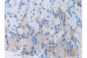 #VALUE! (Leptin 抗体  (AA 22-167))