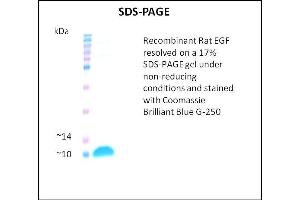 SDS-PAGE (SDS) image for Epidermal Growth Factor (EGF) (Active) protein (ABIN5509414) (EGF 蛋白)