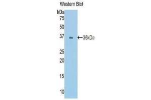 Western Blotting (WB) image for anti-Cadherin 1, Type 1, E-Cadherin (Epithelial) (CDH1) (AA 374-628) antibody (ABIN2901805)