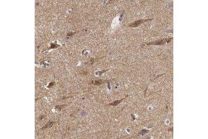 Immunohistochemical staining of human cerebral cortex with NLGN4X polyclonal antibody  shows moderate cytoplasmic positivity in neuronal cells at 1:50-1:200 dilution. (Neuroligin 4 抗体)