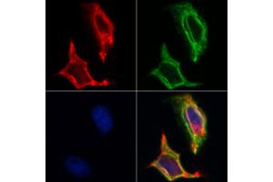 ABIN6262608 and ABIN6268730 staining Hela by IF/ICC. (ITGA3 抗体  (Internal Region))