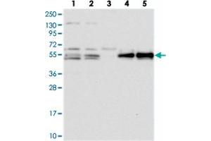 Western blot analysis of Lane 1: RT-4, Lane 2: U-251 MG, Lane 3: Human Plasma, Lane 4: Liver, Lane 5: Tonsil with PRRC1 polyclonal antibody . (PRRC1 抗体)