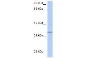 C3ORF62 antibody used at 1 ug/ml to detect target protein. (C3orf62 抗体  (Middle Region))
