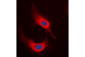 Immunofluorescent analysis of Desmin staining in HeLa cells. (Desmin 抗体  (C-Term))