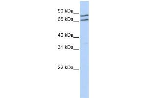 WB Suggested Anti-TFE3 Antibody Titration:  0. (TFE3 抗体  (Middle Region))