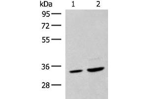 Western blot analysis of Hela cell and Human fetal liver tissue lysates using SCGN Polyclonal Antibody at dilution of 1:600 (SCGN 抗体)