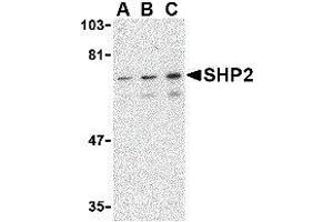Western Blotting (WB) image for anti-Protein tyrosine Phosphatase, Non-Receptor Type 11 (PTPN11) (C-Term) antibody (ABIN2476469) (PTPN11 抗体  (C-Term))