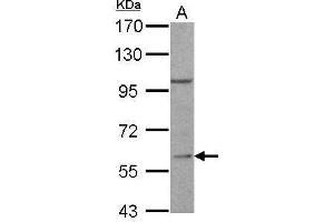 WB Image RGS14 antibody [C3], C-term detects RGS14 protein by Western blot analysis.