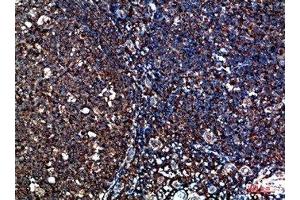 Immunohistochemistry (IHC) image for anti-Cytoplasmic FMR1 Interacting Protein 2 (CYFIP2) (AA 1171-1220) antibody (ABIN7180298)
