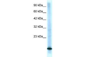 CDKN2B antibody (70R-10487) used at 0. (CDKN2B 抗体  (Middle Region))