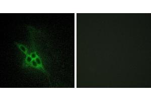 Peptide - +Immunohistochemistry analysis of paraffin-embedded human brain tissue using EPHB1/2/3 antibody. (EPH Receptor B1/2/3 (Internal Region) 抗体)