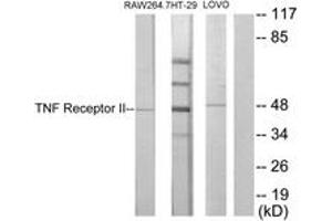 Western Blotting (WB) image for anti-Tumor Necrosis Factor Receptor Superfamily, Member 1B (TNFRSF1B) (AA 376-425) antibody (ABIN2889419) (TNFRSF1B 抗体  (AA 376-425))